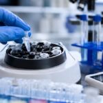 Los fármacos GLP-1 se asocian con menos casos de tuberculosis entre personas con diabetes tipo 2 2 Mano enguantada en laboratorio clinico