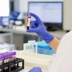 Inspeccion de muestras de sangre en laboratorio