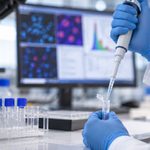 Un anticuerpo experimental logra remisión al año en seis de diez pacientes evaluables con lupus en un pequeño ensayo 3 Pipeteo en laboratorio biomedico